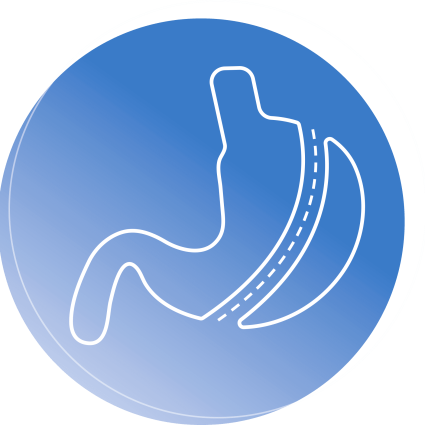 stomach_surgery_img stomach_surgery_img